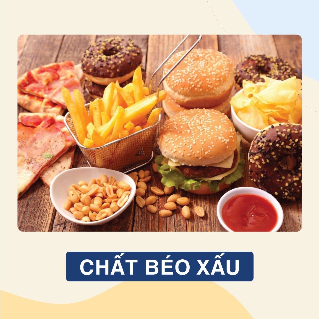 Các loại chất béo xấu có thể tăng nguy cơ hình thành sỏi vì vậy bạn nên hạn chế sử dụng các loại chất béo này 