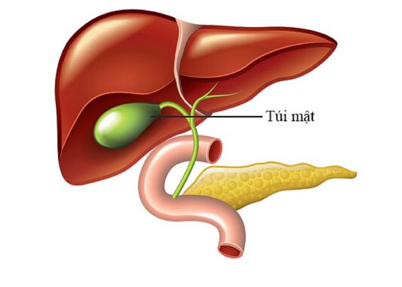 Polyp túi mật là gì và polyp túi mật khi nào cần mổ? | Medlatec