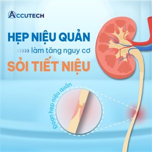 hẹp niệu quản gây sỏi tiết niệu