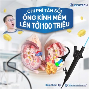 Chi phí tán sỏi ống mềm