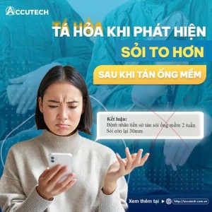 Sỏi to hơn sau tán ống mềm