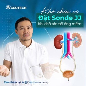 Đặt ống thông JJ trước tân sỏi